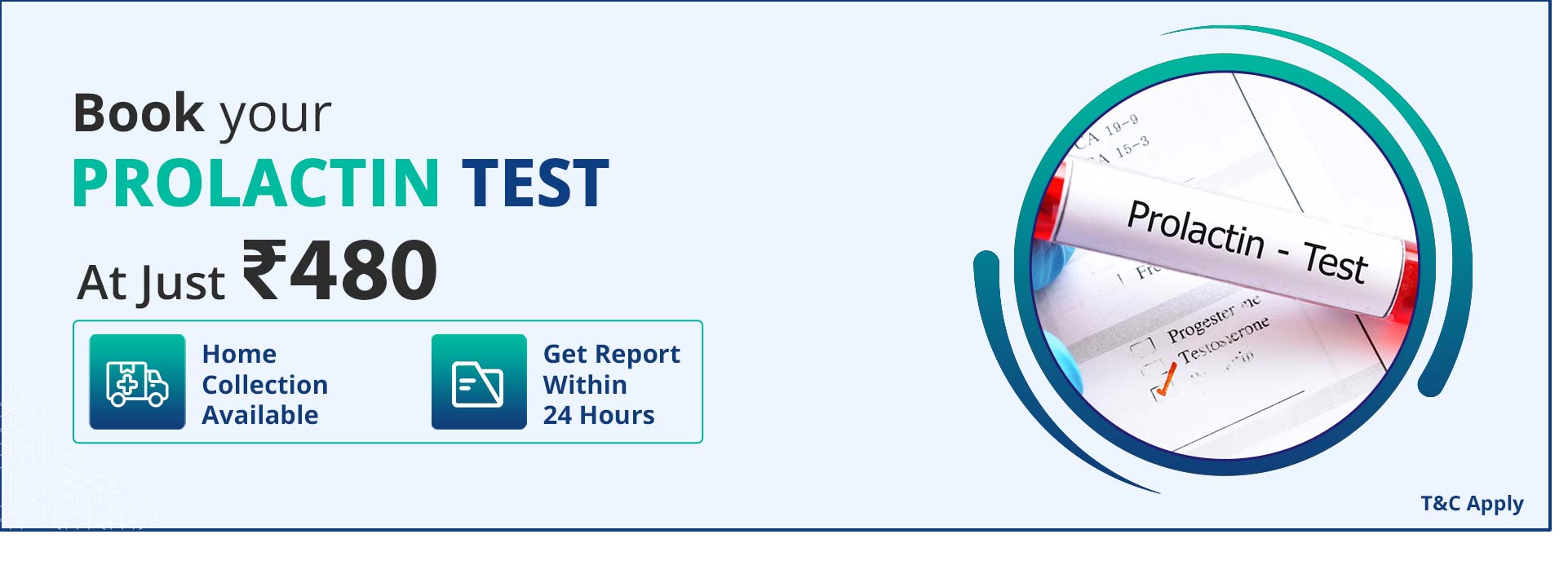 Prolactin Test